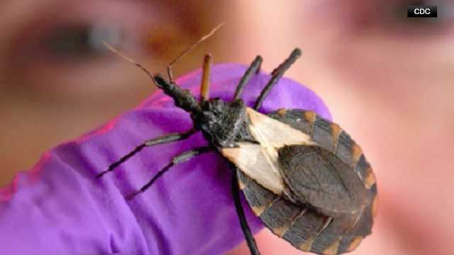 Doctor warns of kissing bug's link to heart failure