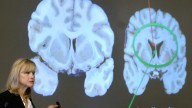 What is Chronic Traumatic Encephalopathy? NFL HQ shooter diagnosis explained