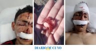 Salvaje ataque: dos hermanos golpearon a un joven hasta desfigurarlo frente a su hijo de 7 años