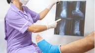 Científicos chinos crean Bone 02, un gel que repara fracturas en 3 minutos