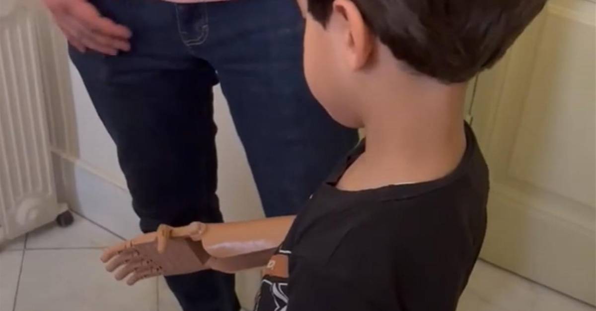 La historia de una ONG que entrega prótesis impresas en 3D a niños víctimas de bombardeos en Gaza