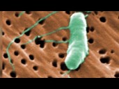 Flesh-eating bacteria kills fifth person this year in Louisiana