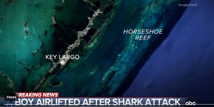 Boy bitten by shark in Key Largo recovering after surgery, family says