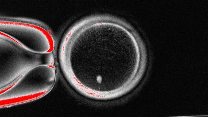 Human eggs from skin cells: 'Partially works, and partially doesn't'