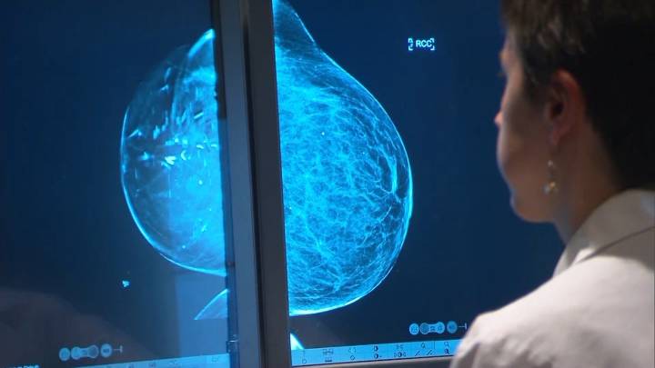 Mobile Mammography Van is coming to Steuben County in October