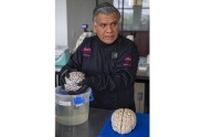 Biobanco Nacional de Demencias avanza en el estudio de métodos de diagnóstico no invasivos