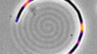 Descubren cómo las bacterias guardan 'memoria' de los antibióticos: así podrían diseñarse nuevos tratamientos