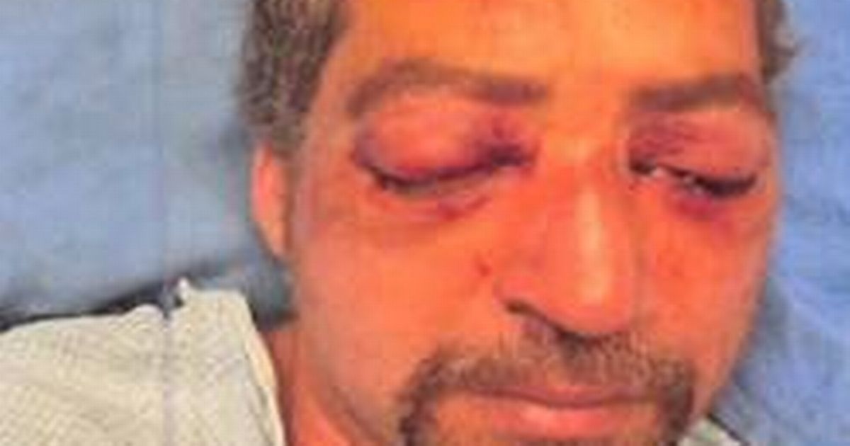Man recalls horrifying 'pop' as road rage driver 'used thumbs to gouge eyes out'