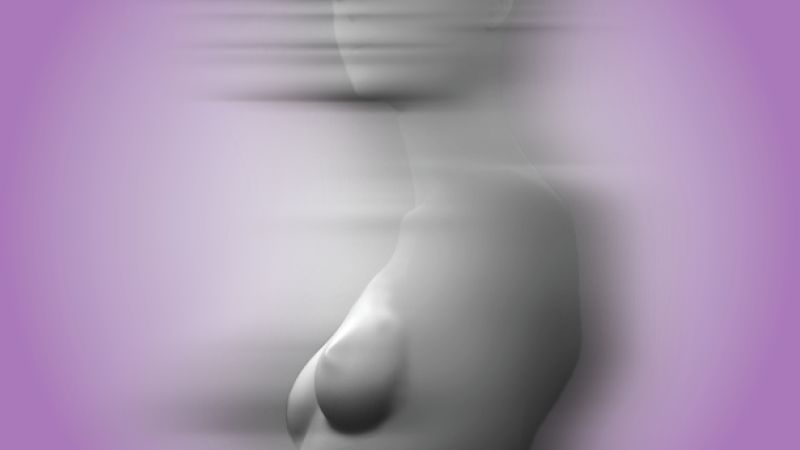 ‘Isn’t it your choice to take them out?’: Why breast explant surgery is on the rise