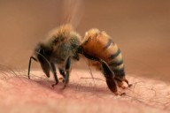 Picadura de abeja puede ser mortal si la persona es alérgica, advierte el Minsa