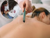 Cómo sacar cita en la clínica de acupuntura del IPN