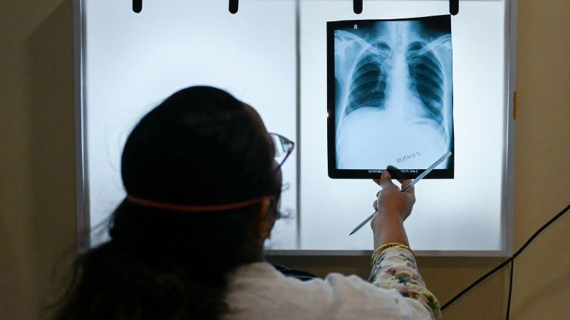 This country’s government vowed to eliminate TB by the end of 2025. It’s not going well.