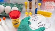 Bird flu confirmed in Allegan County backyard flock