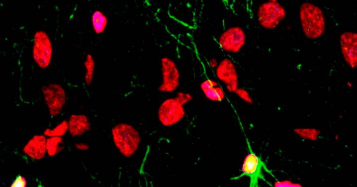 Las enfermedades mentales, el alcohol y las drogas lastran la producción de neuronas nuevas