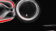 La ciencia consigue crear óvulos humanos a partir de células de la piel
