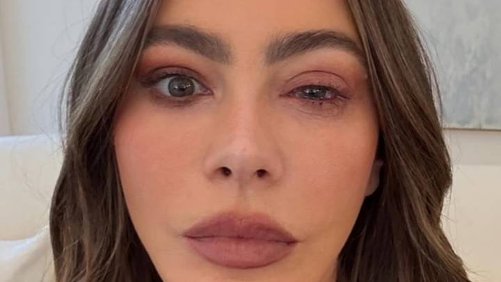 Sofía Vergara forced to skip 2025 Emmy Awards after suffering 'eye allergy'