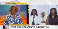 Living with Hidradenitis Suppurativa
