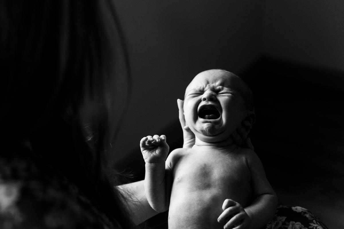 Newborn Syphilis Cases Climb As STI Rates Remain High