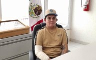 Unidad de Quemados del IMSS Juárez salva la vida a su primer paciente