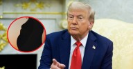 Trump lanza advertencia sobre uso de paracetamol en embarazadas por su relación con el autismo
