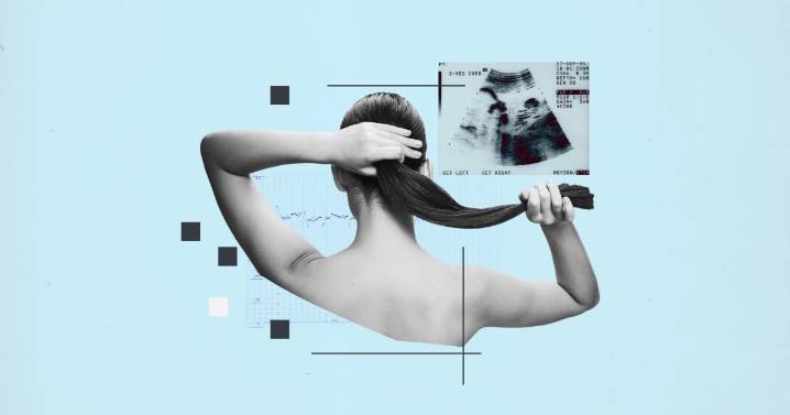 Hair Treatment You Should Avoid When Trying To Conceive, Says Doctor