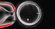 U.S. researchers turn human skin cells into fertilizable eggs