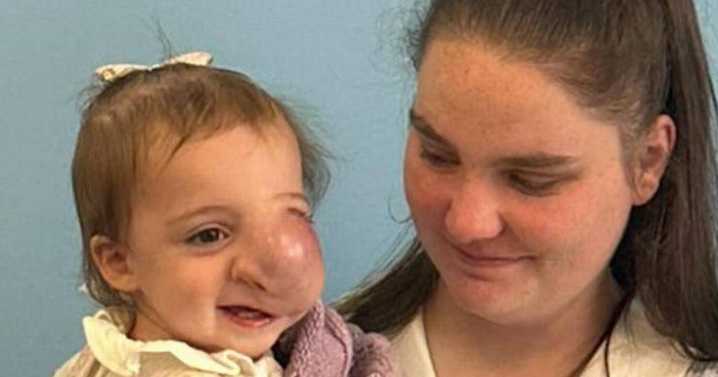 Tot dies from cancer after doctors assumed lump on face was 'caused by parents'