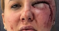 'My boyfriend left me looking like this, and was in jail for just two months'