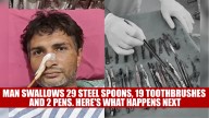 Man Swallows 29 steel spoons, 19 toothbrushes and 2 pens. Here’s What Happens Next