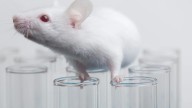 Revelan cambios en el cerebro que predisponen a sufrir alzhéimer y tumores