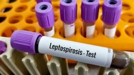 Leptospirosis death reported as Chicago issues health alert