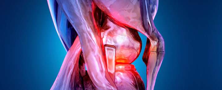 Signs of Rheumatoid Arthritis Uncovered Years Before Symptoms Appear