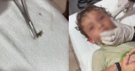 VIDEO: ¿Nuevo miedo desbloqueado? Así fue como un cangrejo entró al oído de un niño
