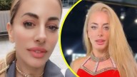 Catalina Palacios recibe ola de críticas tras realizarse nuevo retoque estético en su rostro: "Jamás pararé"