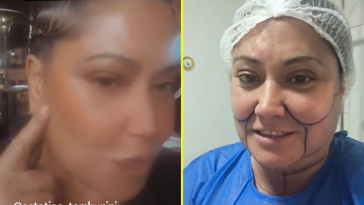 Denisse Campos anunció que se someterá a nuevo procedimiento estético: "Tienen que rezar por mí"