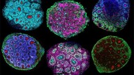 Los organoides cerebrales podrían adquirir consciencia y sentir dolor: ¿estamos preparados?