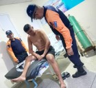 ¡Drama en la carretera! Deslizamiento de moto en El Hato – Adícora deja a dos heridos graves.