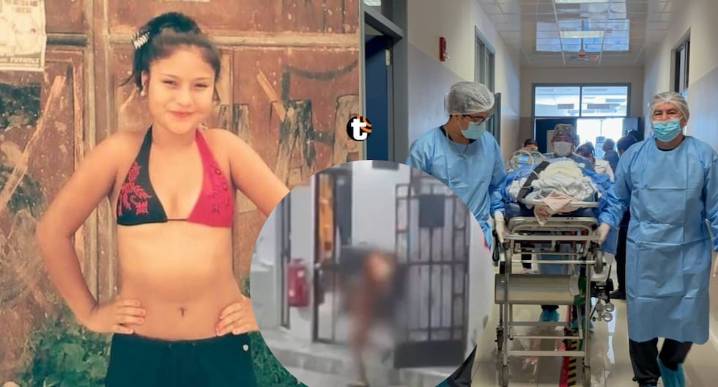 ¡Horror en Tingo María! Joven llegó envuelta en llamas a un grifo y ahora lucha por su vida en Lima Janela Alva Loyola (26) permanece en UCI del Hospital Arzobispo Loayza con el 40% del cuerpo quemado