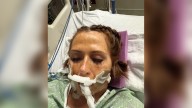 Mom, 49, left on the brink of death with organs failing after small cut infected by flesh