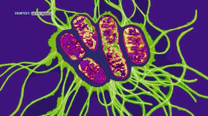 Typhoid detected in Capital Region school