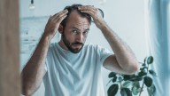 Hair shedding and thinning may be linked to protein deficiency in diet