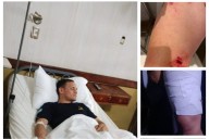 VIOLENCIA! Policías correntinos heridos durante una revuelta vecinal (IMÁGENES SENSIBLES)