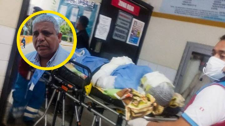 Evalúan estado de herido grave por deflagración en Caravelí