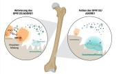 Un avance científico haría posible revertir la osteoporosis