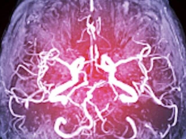 Las emociones refuerzan la memoria: un hallazgo revela cómo el cerebro decide qué recordar