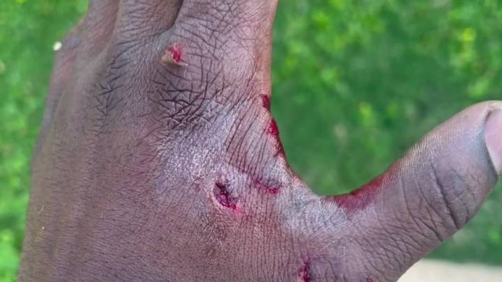 Houston man sues southwest side apartment complex claiming neighbor's dog violently attacked him
