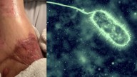 Bacteria come carne, en aumento: cómo el calentamiento de los océanos está poniendo en riesgo tu salud
