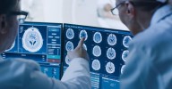 El mapa del cerebro que debe ayudar a encontrar el origen del Alzheimer