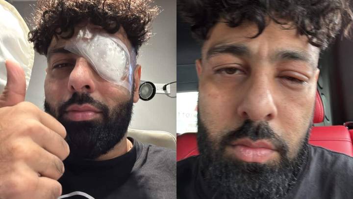 What happened to rapper Badshah? Viral photo shocks fans