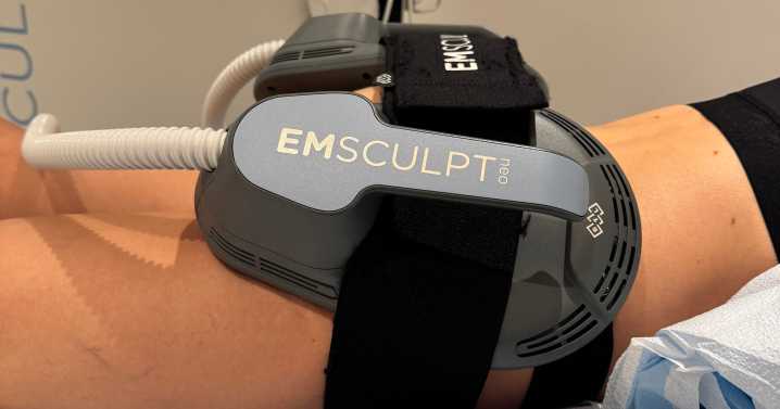I Tried Emsculpt Neo For a Butt Lift: See Photos